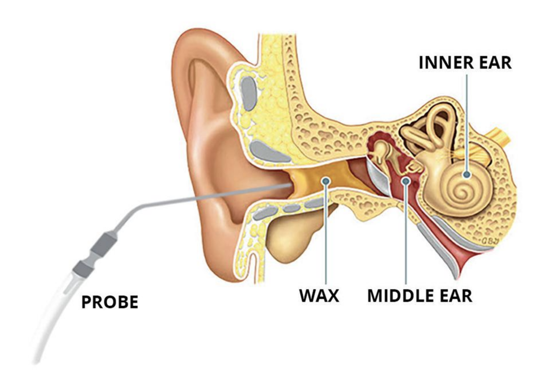 All Clear Hearing All Clear Hearing Ltd Hearing aid and ear wax